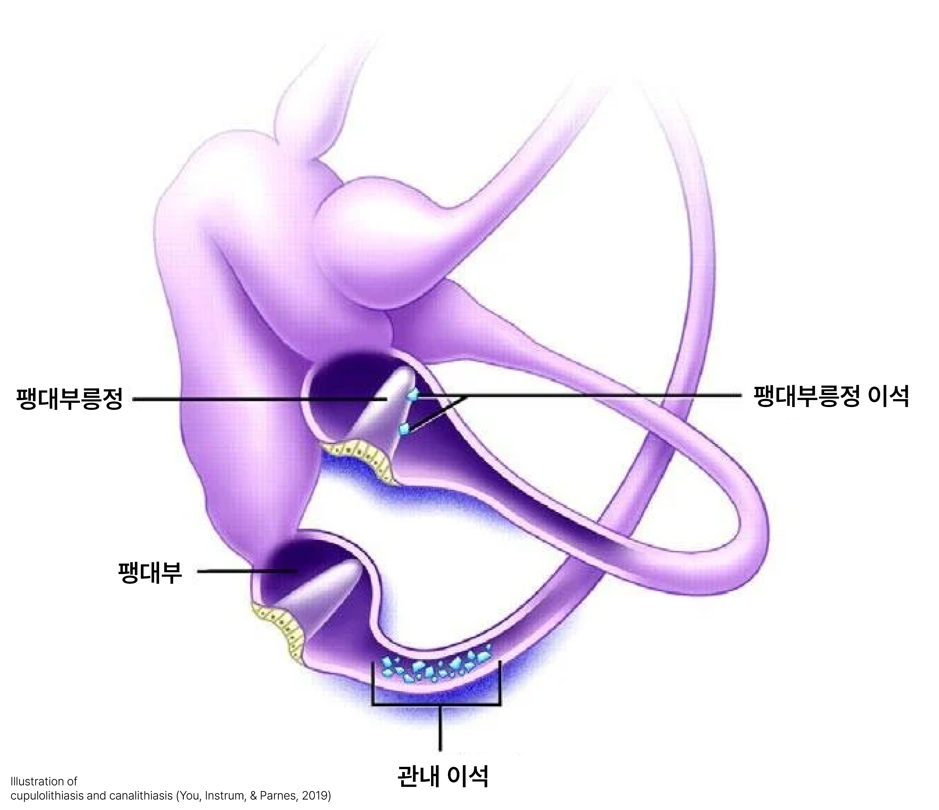 이석증 발생 원리